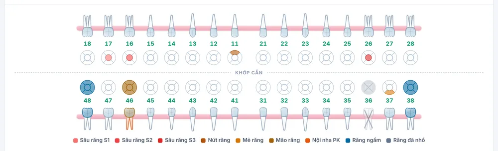 Phiếu tình trạng răng với sơ đồ răng, đánh dấu sâu răng, răng đã nhổ, răng ngầm
