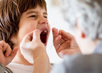 Nhổ răng sữa cho bé và hướng dẫn chi tiết từ các nha sĩ