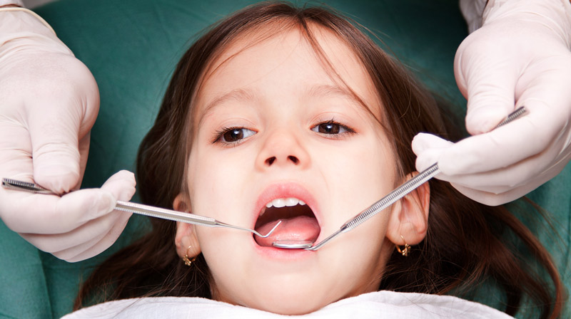 Phụ huynh nên chú ý việc niềng răng cho trẻ sớm nhất có thể 