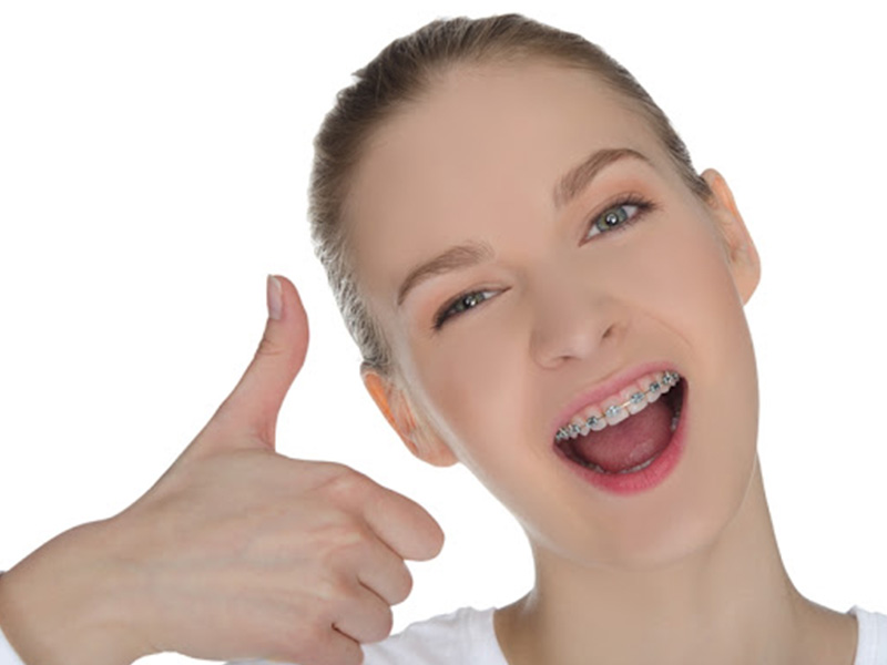 Hiệu quả niềng răng móm phụ thuộc vào nhiều yếu tố như độ tuổi và tình trạng của răng