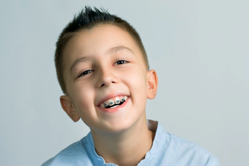 Trẻ nhỏ có thời gian niềng răng ngắn hơn so với người trường thành