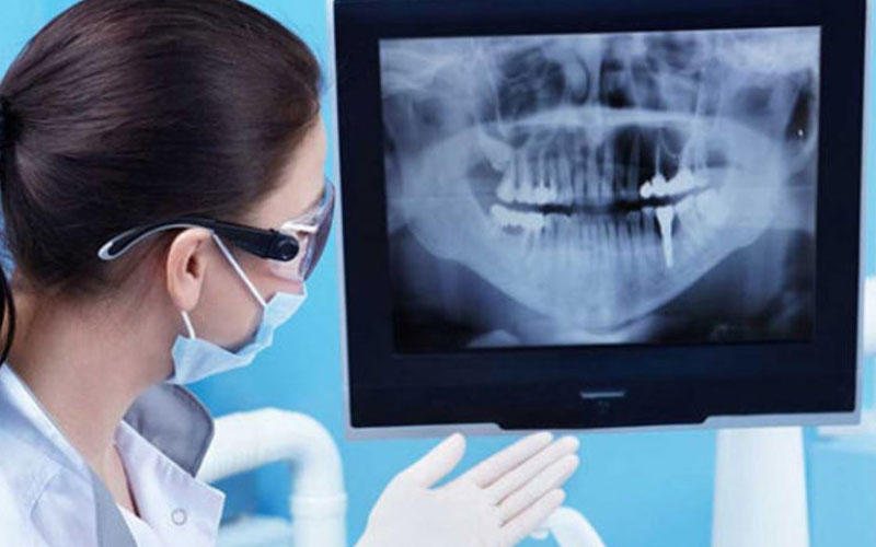 Bệnh nhân sẽ được chụp X-quang răng trước khi điều trị