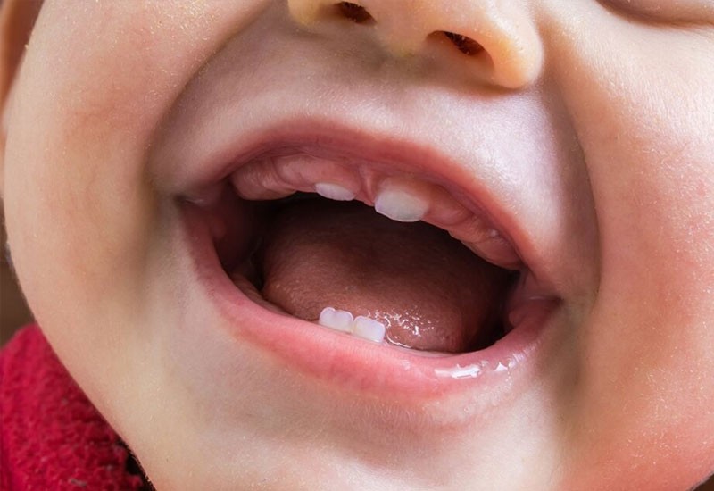 Thông thường bé sẽ bắt đầu mọc răng vào khoảng từ 6 tháng tuổi 