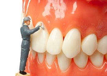 Chăm sóc răng miệng tỉ mỉ sau khi lấy cao là cách giảm ê buốt hiệu quả.