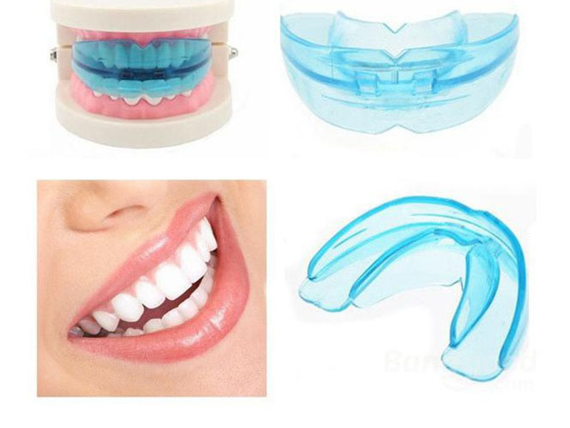 Bộ dụng cụ niềng răng tại nhà 3 giai đoạn được cung cấp khá phổ biến trên thị trường