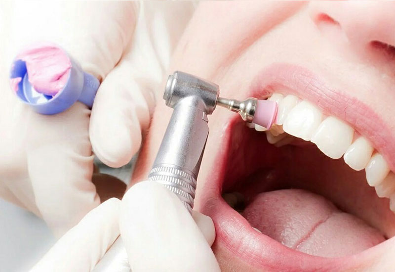 Đến cơ sở nha khoa khám và điều trị để giải quyết dứt điểm đau răng hàm