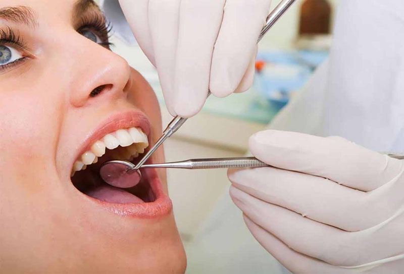 Vệ sinh răng miệng sạch sẽ trước khi hàn trám răng