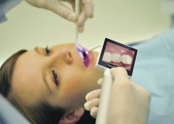 Máy ảnh trong miệng đã chính thức có mặt tại Viện Nha khoa Vidental
