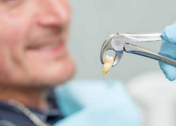 Thời gian trồng lại răng bao lâu còn tùy thuộc vào tình trạng của từng bệnh nhân