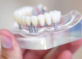 Trồng răng giả cố định là phương pháp giúp phục hình răng phù hợp với những trường hợp bị mất răng