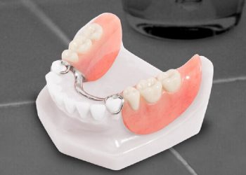 Trồng răng giả tháo lắp là cách phục hình răng bị mất phù hợp với người cao tuổi