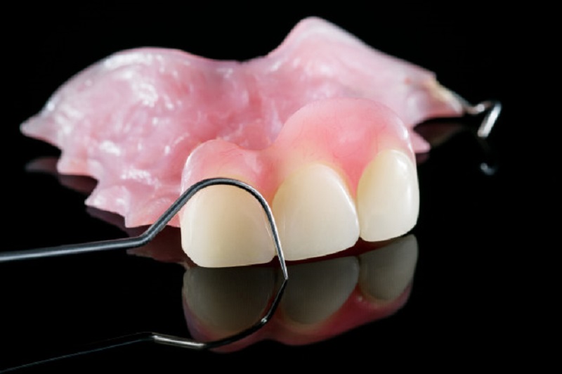 Răng giả tháo lắp nhựa dẻo thường sở hữu độ co kéo tốt