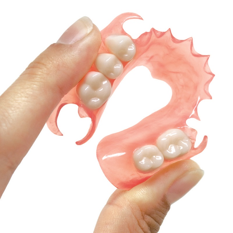 Trồng răng hàm giả hồi phục lại các răng ở vị trí số 6, 7
