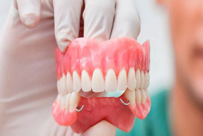trồng răng hàm giá bao nhiêu