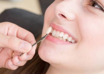 Cần gặp bác sĩ để được tư vấn chi tiết trước khi thực hiện trồng răng khểnh