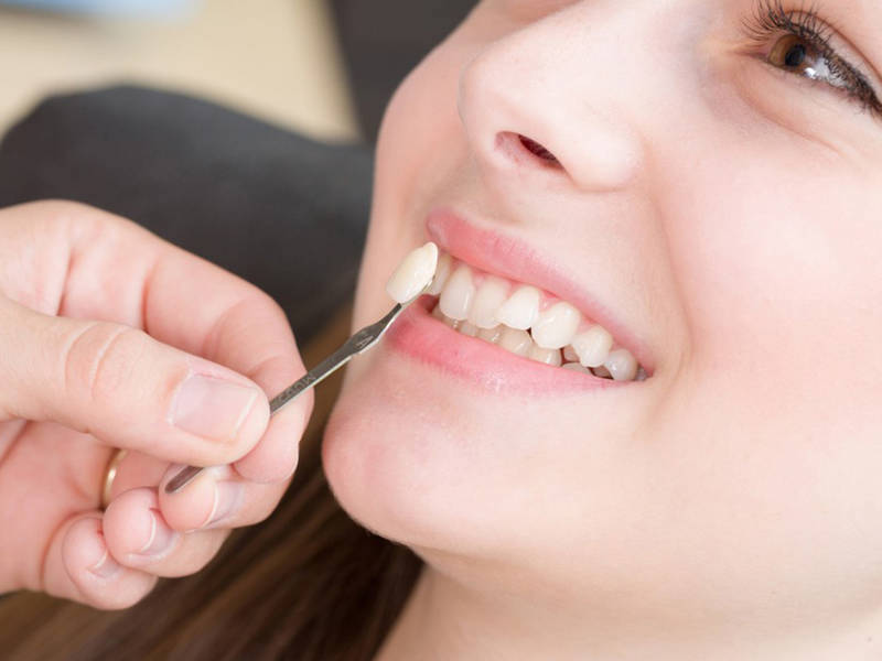 Cần gặp bác sĩ để được tư vấn chi tiết trước khi thực hiện trồng răng khểnh
