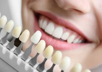 Trồng răng sứ có đau không luôn là nỗi băn khoăn của phần lớn khách hàng