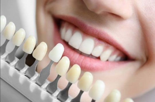 Trồng răng sứ có đau không luôn là nỗi băn khoăn của phần lớn khách hàng