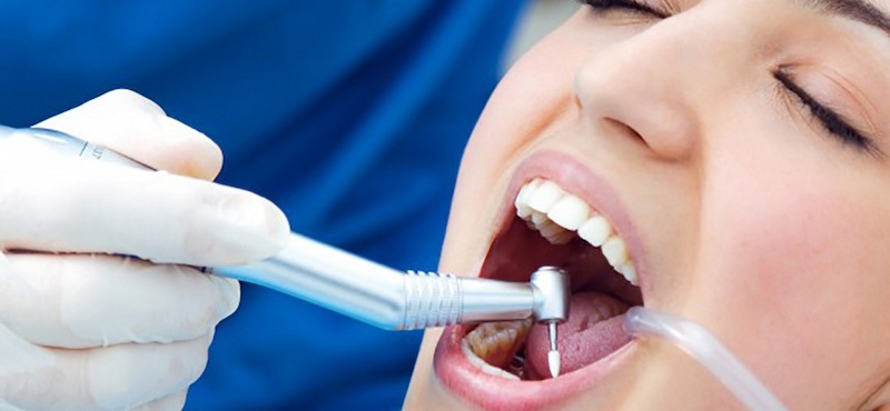 Bác sĩ tiến hành cấy răng đúng quy trình mới đảm bảo hiệu quả bền lâu
