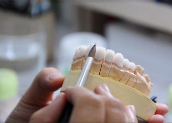 Trồng răng sứ là phương pháp nha khoa giúp phục hình những khuyết điểm trên răng