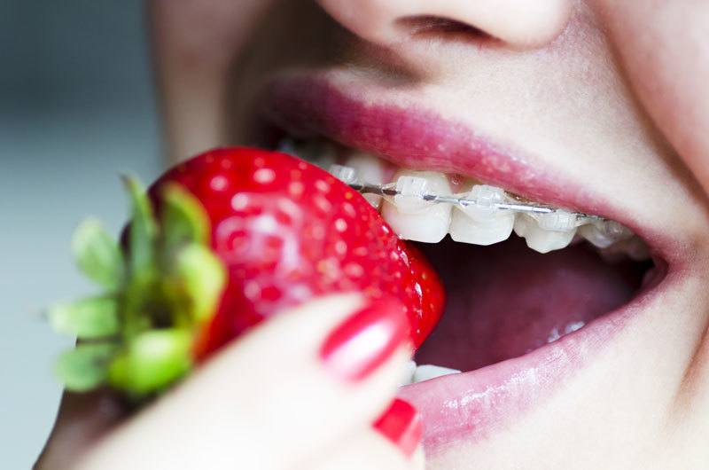 Sau khi niềng răng, bạn nên bổ sung các loại trái cây tươi