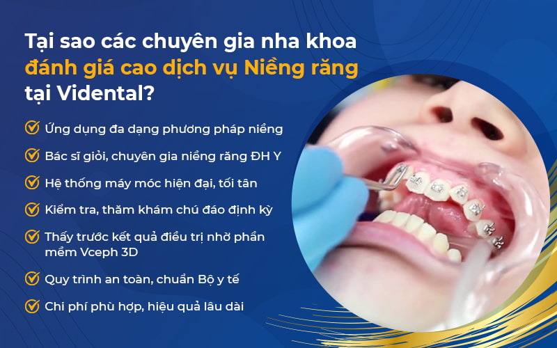 Chất lượng dịch vụ niềng răng ViDental