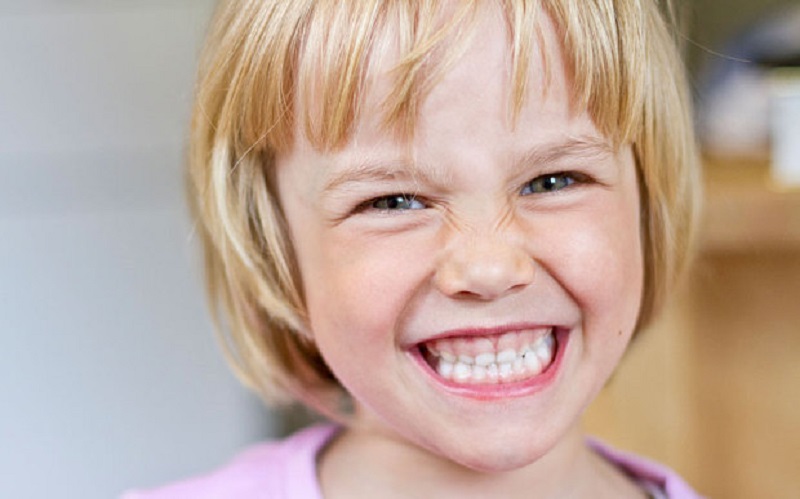 Trẻ mọc được 12 - 20 răng sữa