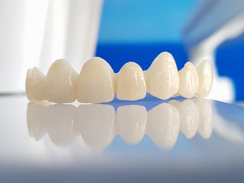 Bọc răng sứ không kim loại là phương pháp sử dụng các mão răng được làm từ 100% sứ cao cấp
