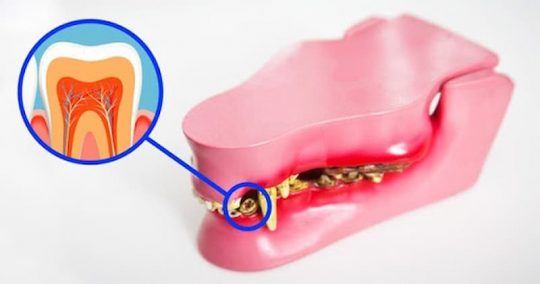 Công nghệ khiến răng tự mọc lại sau khi rụng: Tin được không?