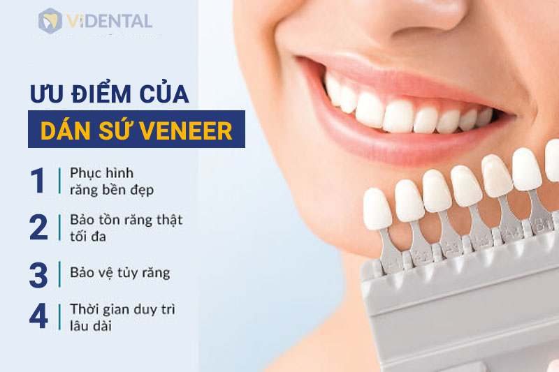 Dán sứ là một trong những phương pháp răng thẩm mỹ ưu việt nhất hiện nay