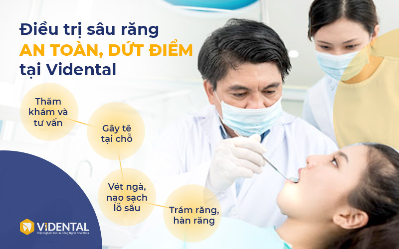 Điều trị sâu răng tại Viện nha khoa Vidental