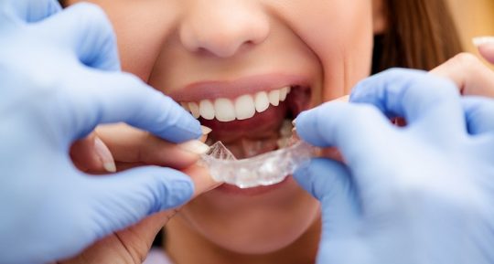 Chi phí niềng răng cho mỗi bệnh nhân luôn khác nhau và phụ thuộc vào nhiều yếu tố
