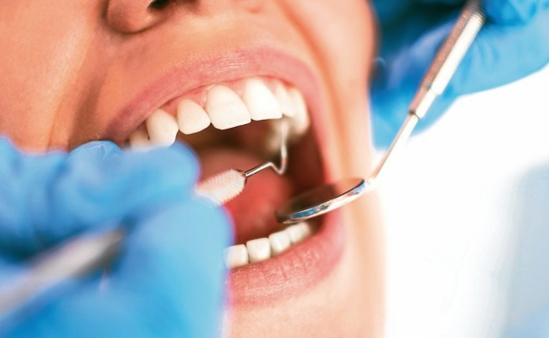 Răng khôn hàm dưới bên trái mọc lệch cần đến nha khoa để kiểm tra và xử lý kịp thời