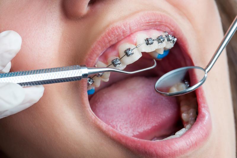 Người bệnh nên thăm khám định kỳ với tại nha khoa để theo dõi tiến đội niềng răng