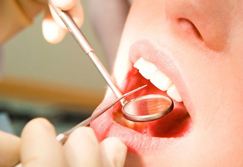 Hiệu quả và ảnh hưởng của quá trình cạo vôi răng sẽ ảnh hưởng bởi rất nhiều yếu tố
