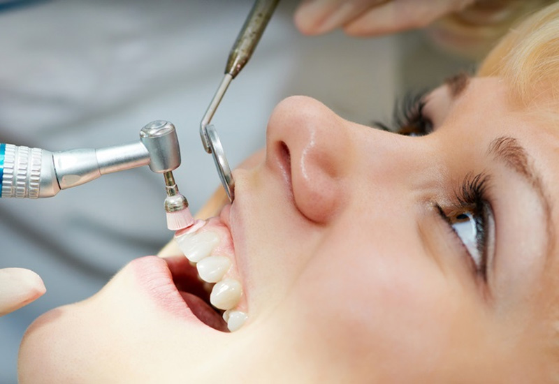 Tần suất cạo vôi răng mà các bác sĩ khuyến cáo là 3 - 6 tháng/lần
