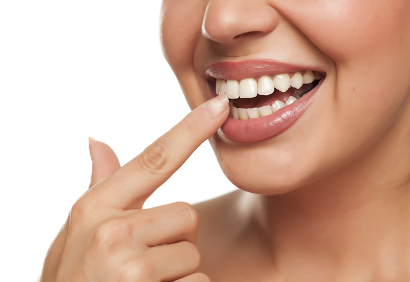 Cạo vôi răng định kỳ mang lại rất nhiều lợi ích
