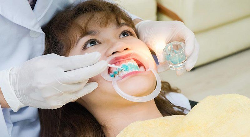 Bạn có thể đến nha khoa để thực hiện tẩy trắng răng