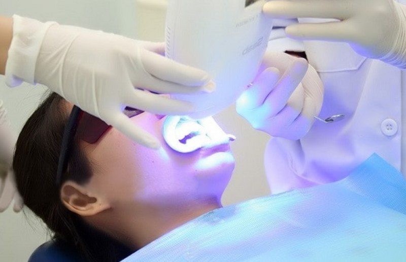 Nên thực hiện ở nha khoa uy tín để tránh tác hại của tẩy trắng răng
