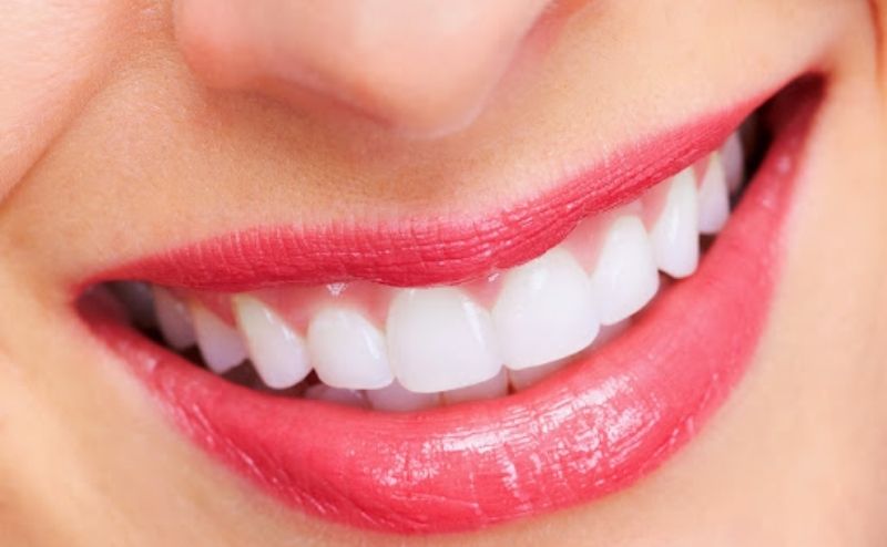 Nha khoa Đông Nam được nhiều khách hàng phản hồi rất tốt về dịch vụ tẩy trắng răng 