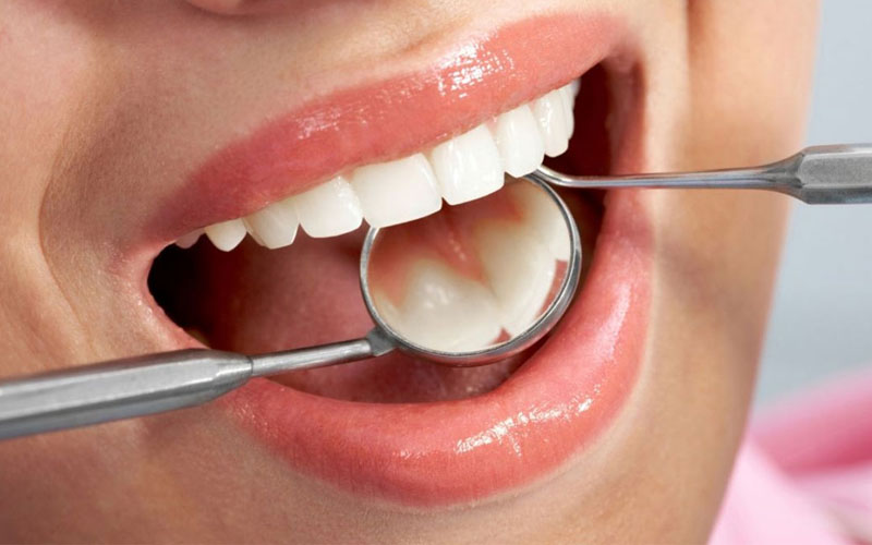 Lựa chọn những cơ sở y tế uy tín để điều trị viêm tủy răng