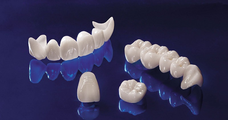 Răng sứ Cercon - Loại răng sứ được nhiều ngôi sao lựa chọn