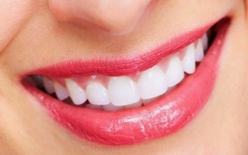 Bọc răng sứ giúp bạn có được nụ cười tự tin và đẹp hơn
