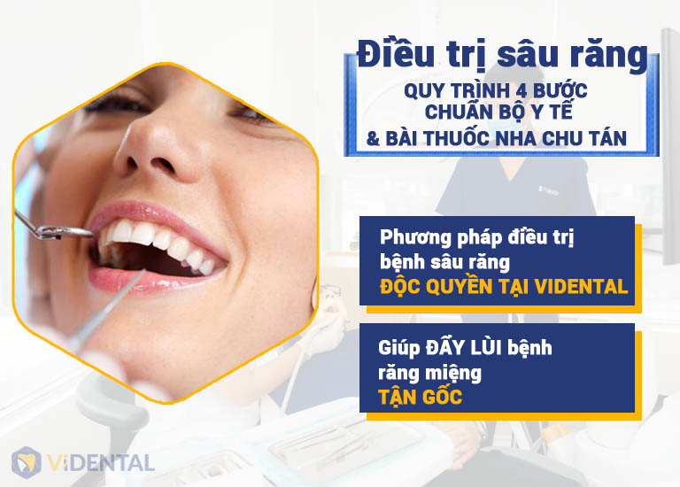Bài thuốc Nha Chu Tán phù hợp với khách hàng trước và trong niềng răng