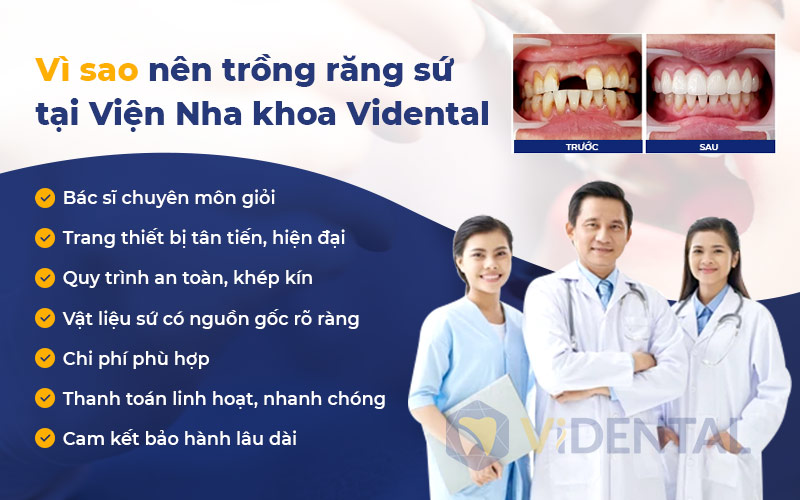 ViDental là sự lựa chọn hàng đầu khi khách hàng có nhu cầu trồng răng sứ