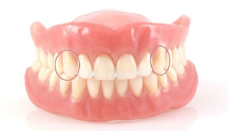 Vị trí của răng số 3 gần với nhóm răng cửa