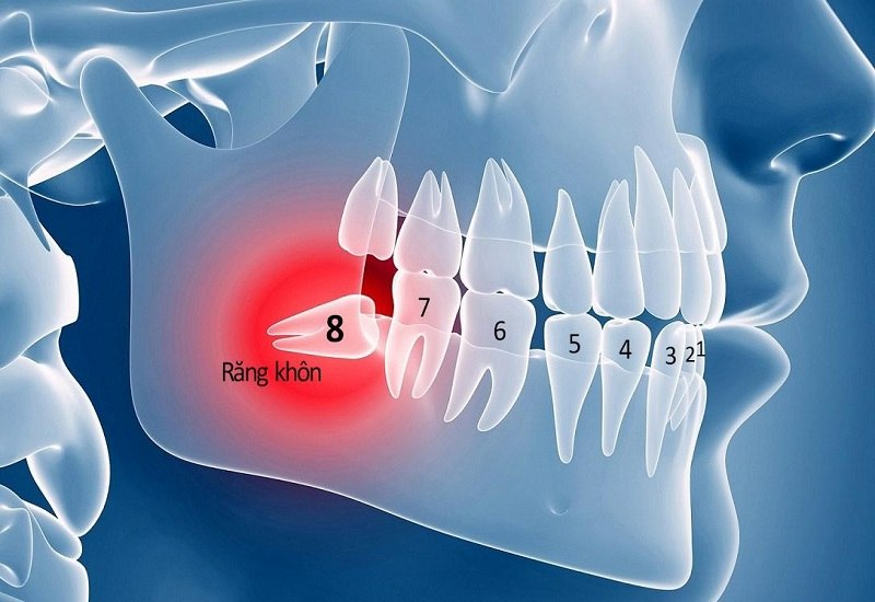 Răng số 5 là răng hàm nhỏ, nằm ở vị trí số 5 tính từ răng cửa