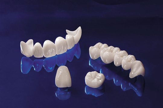 Răng sứ Cercon là loại răng sứ thẩm mỹ được đánh giá cao