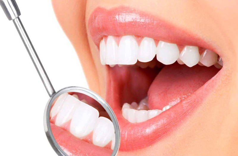 Về cơ bản, khách hàng nếu muốn bọc từ 1-2 răng sứ sẽ mất khoảng 3 ngày
