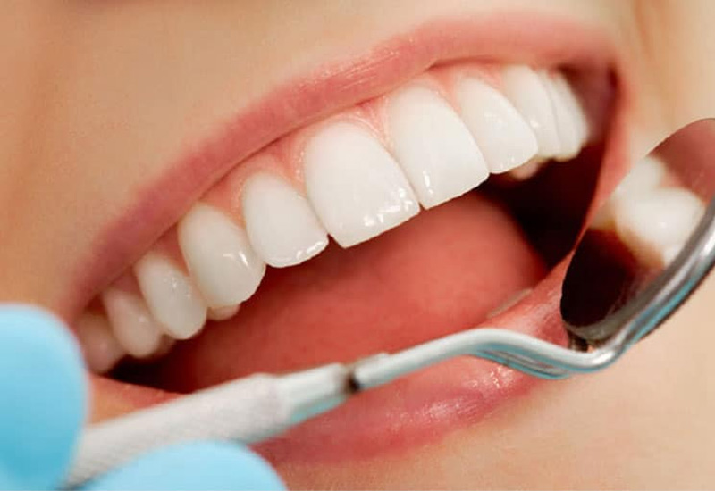 Tình trạng răng miệng cũng sẽ quết định bọc răng sứ nguyên hàm giá bao nhiêu